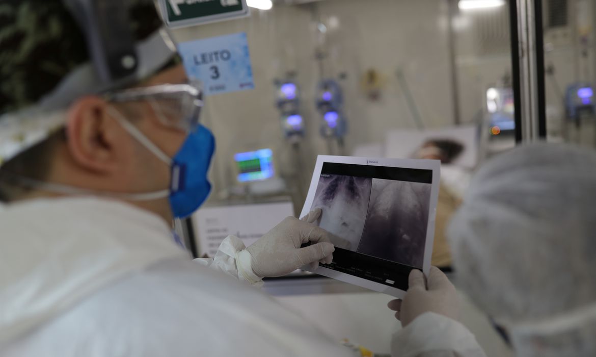 _radiografia_de_torax_coronaviruscovid-19_hospital_sao_paulo1205200326