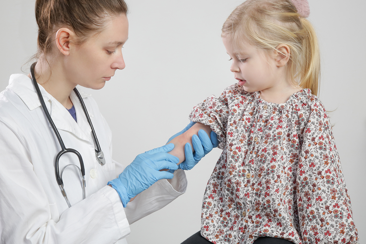 Doctor,Looking,At,Red,And,Itchy,Eczema,On,Little,Girl's