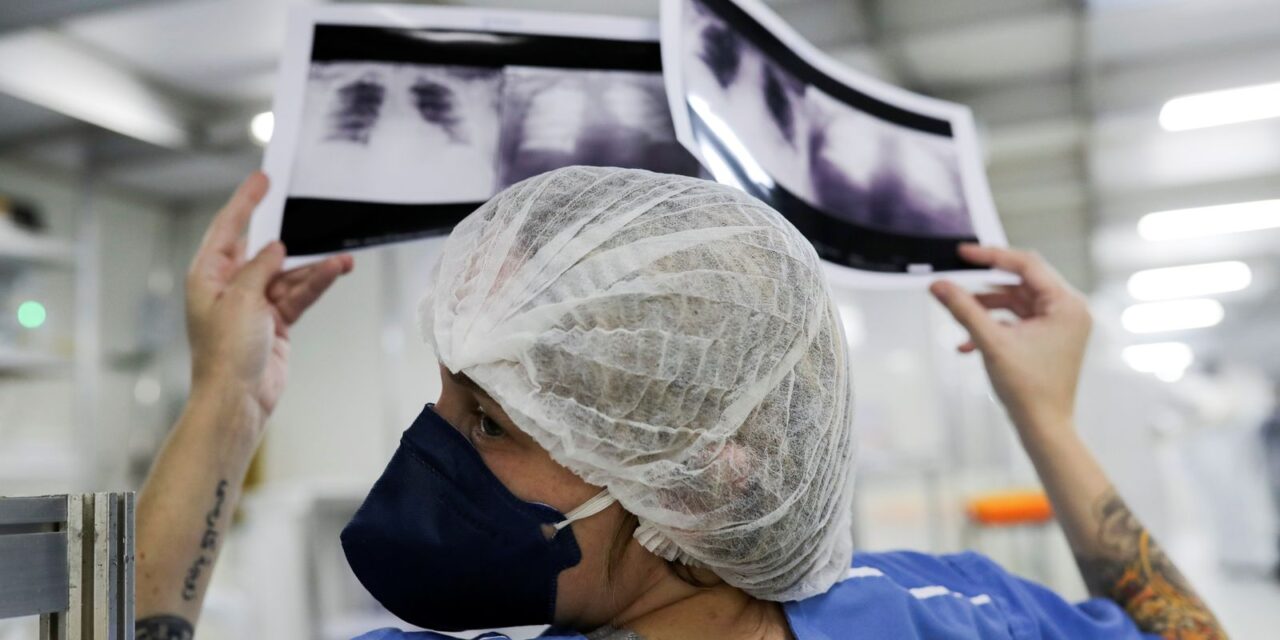 radiografia_de_torax_coronaviruscovid-19_hospital_sao_paulo1205200325.jpg