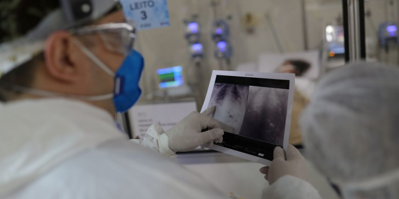 radiografia_de_torax_coronaviruscovid-19_hospital_sao_paulo1205200326.jpg